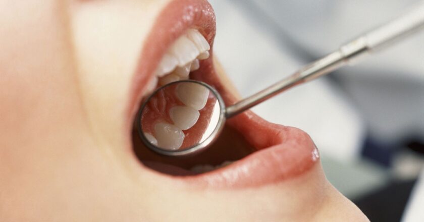 Common Dental Problems and Their Solutions: A Comprehensive Guide