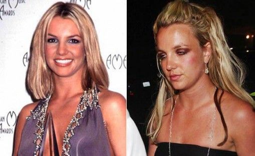 Britney Spears and Drugs: A Troubled History
