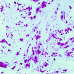 What is LBP and Why is it Measured Using ELISA
