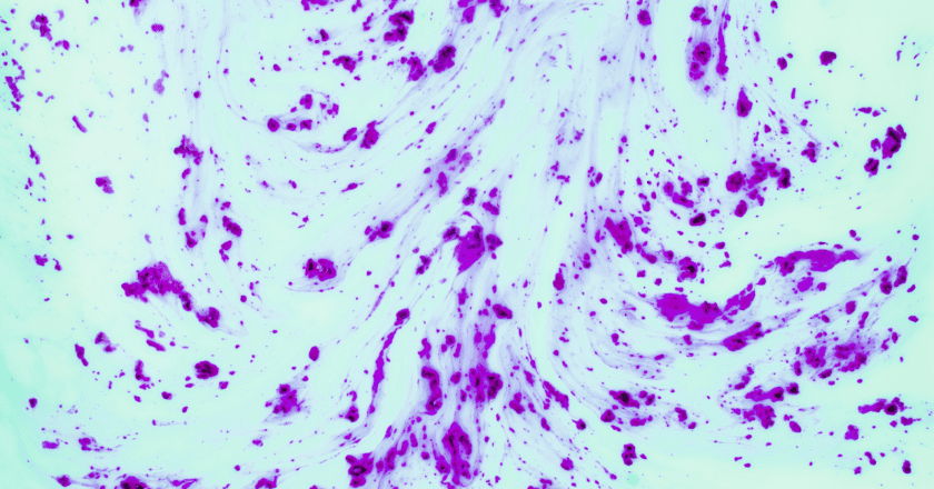 What is LBP and Why is it Measured Using ELISA